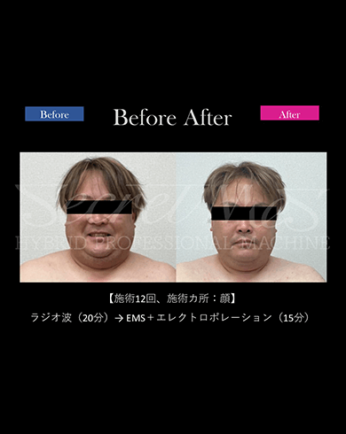 Before Afterのイメージ